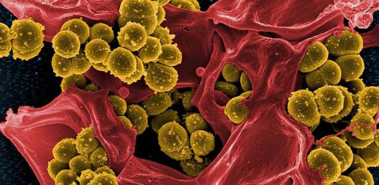 Mucus Und Die Meaning Von Different Farbstoffe