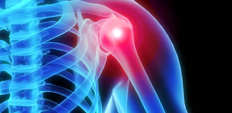 Ein Beginner's Ratgeber zu Verstehen Inflammation